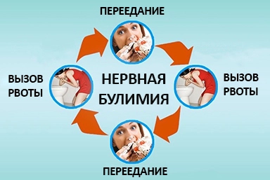 Лечение булимии в Чернышевске